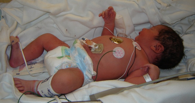 baby in incubator. 